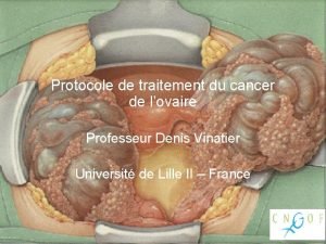 Protocole de traitement du cancer de lovaire Professeur
