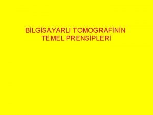 BLGSAYARLI TOMOGRAFNN TEMEL PRENSPLER GR Bilgisayarl tomografi 1972