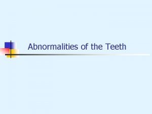 Abnormalities of the Teeth Environmental Effects on Tooth