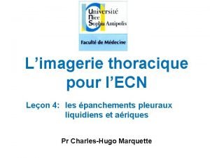 Limagerie thoracique pour lECN Leon 4 les panchements