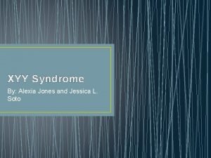 Xyy syndrome