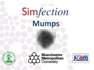 Mumps Mumps What is mumps Infectious viral illness