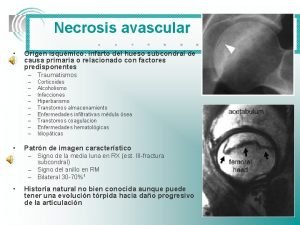 Necrosis avascular Origen isqumico infarto del hueso subcondral