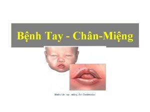 Bnh Tay ChnMing Bnh Tay chn ming c
