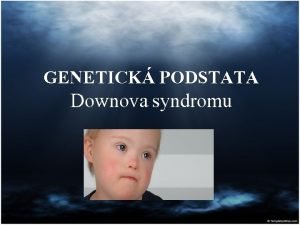 GENETICK PODSTATA Downova syndromu GENETIKA DS odlinost od