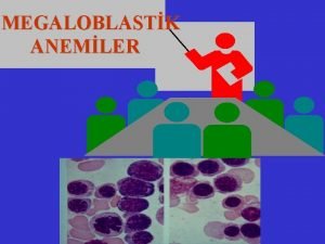 MEGALOBLASTK ANEMLER Anemi tanm WHO kriterlerine gre erikinlerde