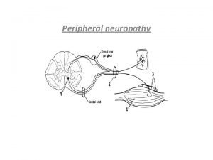 Peripheral neuropathy Peripheral Neuropathy peripheral nerves are composed