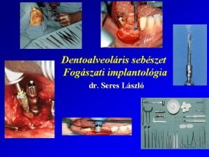 Dentoalveolris sebszet Fogszati implantolgia dr Seres Lszl Dentoalveolris