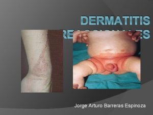 DERMATITIS REACCIONALES Jorge Arturo Barreras Espinoza Dermatitis Reaccinales