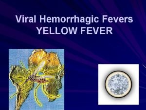 Viral Hemorrhagic Fevers YELLOW FEVER Viral Hemorrhagic Fevers