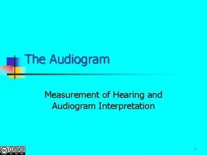 The Audiogram Measurement of Hearing and Audiogram Interpretation