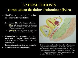 Quiste endometriósico