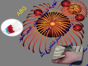 What is an ABG Arterial Blood Gas Drawn