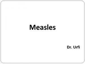 Measles Dr Urfi Measles also known as Rubeola