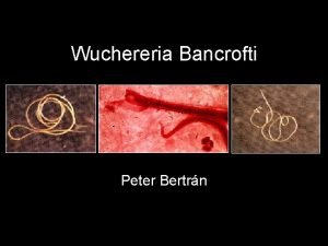 Wuchereria Bancrofti Peter Bertrn Wuchereria Bancrofti Named for