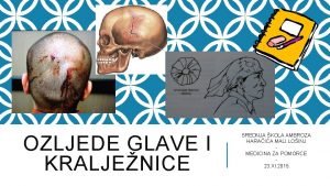 OZLJEDE GLAVE I KRALJENICE SREDNJA KOLA AMBROZA HARAIA