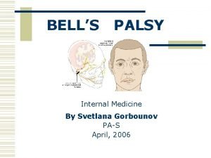 BELLS PALSY Internal Medicine By Svetlana Gorbounov PAS