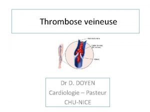 Thrombose veineuse Dr D DOYEN Cardiologie Pasteur CHUNICE