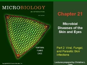 Chapter 21 Microbial Diseases of the Skin and