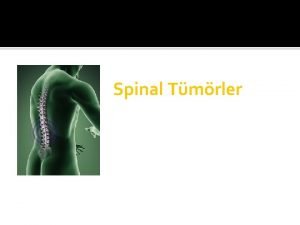 Spinal Tmrler OmurgaOmurilik Anatomi OmurgaOmurilik Anatomi OmurgaOmurilik Anatomi