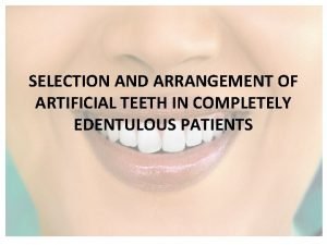 Dentogenic concept of teeth selection