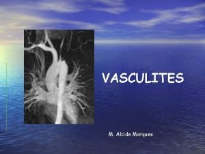 VASCULITES M Alcide Marques VASCULITES Inflamao dos vasos