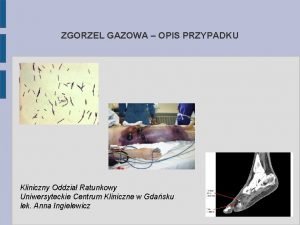 ZGORZEL GAZOWA OPIS PRZYPADKU Kliniczny Oddzia Ratunkowy Uniwersyteckie