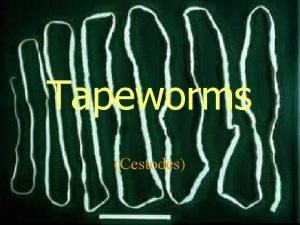 Tapeworms Cestodes Common Tapeworm Infections LAB TAPEWORM Taenia