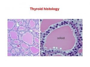 Thyroid histology Thyroid follicular cell Colloid Tg 2