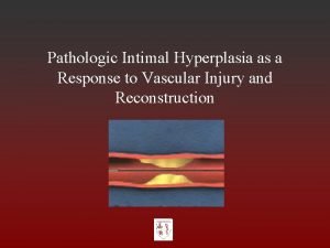 Intimal hyperplasia