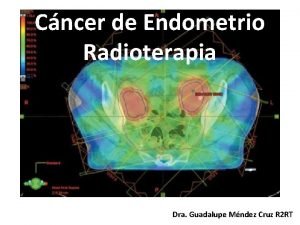 Cncer de Endometrio Radioterapia Dra Guadalupe Mndez Cruz