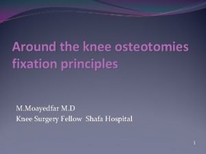Around the knee osteotomies fixation principles M Moayedfar