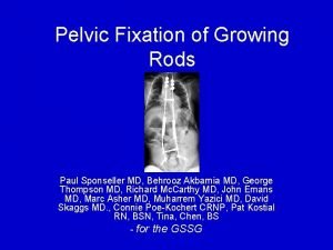 Pelvic Fixation of Growing Rods Paul Sponseller MD