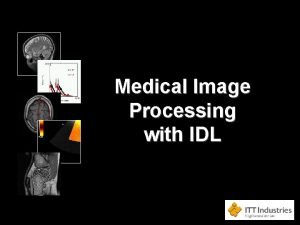 Medical Image Processing with IDL Medical Image Processing