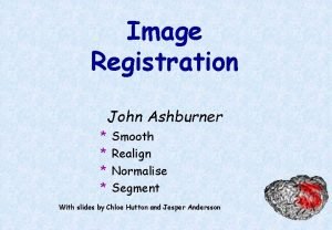 Image Registration John Ashburner Smooth Realign Normalise Segment