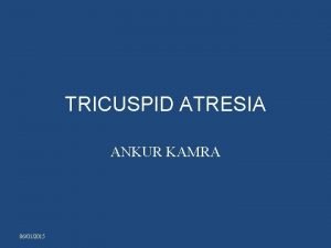 Tricuspid atresia type 1c