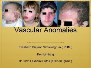 Vascular Anomalies Elisabeth Prajanti Sintaningrum RUM Pembimbing dr