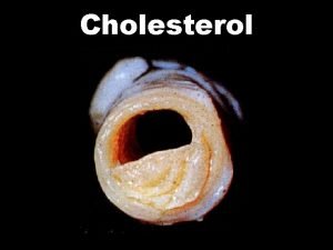Cholesterol Some foods naturally contain cholesterol For example