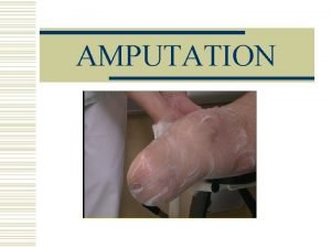 Rôle infirmier amputation