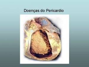 Pericardite definizione