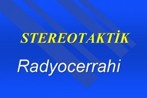 STEREOTAKTK Radyocerrahi RADYASYON ONKOLOJS Afedersiniz Radyoterapiyi aryorum Radyoterapi