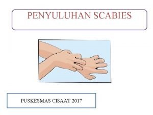 PENYULUHAN SCABIES PUSKESMAS CISAAT 2017 Scabies itu apa