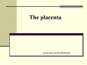 Succenturiate placenta