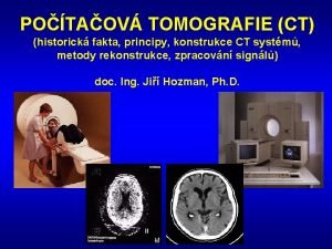 Radonova transformace