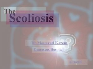 The Scoliosis Dr Mouayad Kazem Damascus Hospital 2742006