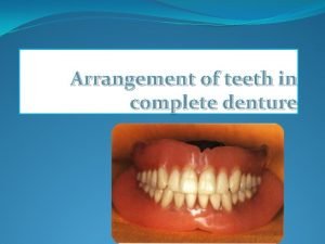 Arrangement of teeth in complete denture The four
