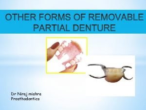 Dr Niraj mishra Prosthodontics GUIDEPLANE RPD SWINGLOCK RPD