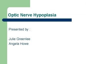 Optic Nerve Hypoplasia Presented by Julie Greenlee Angela