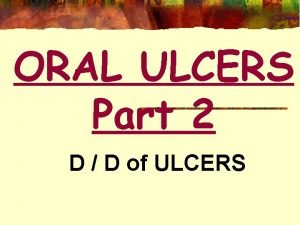 ORAL ULCERS Part 2 D D of ULCERS