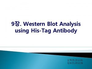 Western blot 원리